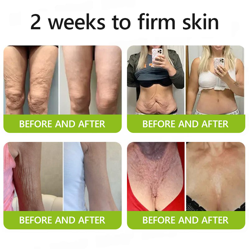 𝑶𝒇𝒇𝒊𝒄𝒊𝒂𝒍 𝑺𝒕𝒐𝒓𝒆👍| Erhalten Sie jetzt jugendliche Haut zurück 💫STDEI® BOTOX & VITA A RETINOL SHOT Faltenstraffende Creme