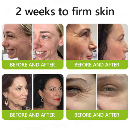 𝑶𝒇𝒇𝒊𝒄𝒊𝒂𝒍 𝑺𝒕𝒐𝒓𝒆👍| Erhalten Sie jetzt jugendliche Haut zurück 💫STDEI® BOTOX & VITA A RETINOL SHOT Faltenstraffende Creme