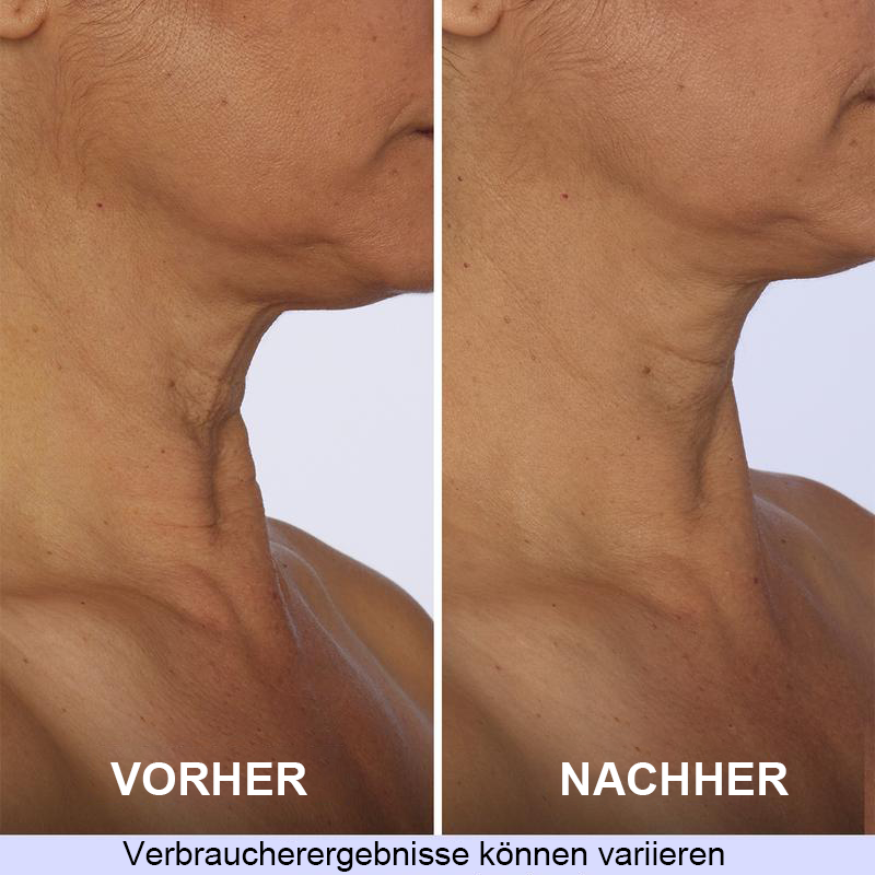 [GOPure offiziell] Halscreme – Straffende Lifting-Creme für schlaffe Haut