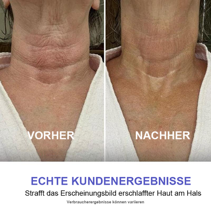[GOPure offiziell] Halscreme – Straffende Lifting-Creme für schlaffe Haut